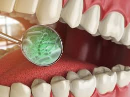 ltoh-the-oral-microbiome-in-health-and-disease.png